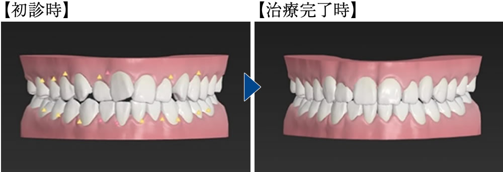 クリアコレクトのシミュレーションを実施
